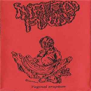 Infected Pussy - Vaginal Eruption FLAC