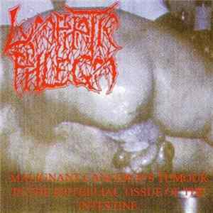 Lymphatic Phlegm / Flesh Grinder - Malignant Cancerous Tumour In The Epithelial Tissue Of The Intestine / From Rotten Process... To Splatter FLAC
