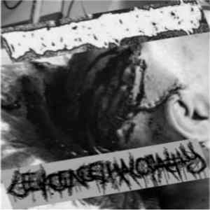 Bowelectomy - Leukoencephalopathy - Split FLAC