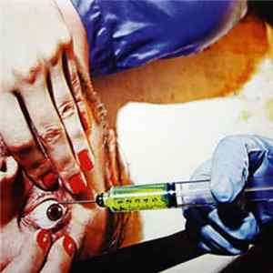 Racebannon - IV: Acid Or Blood FLAC