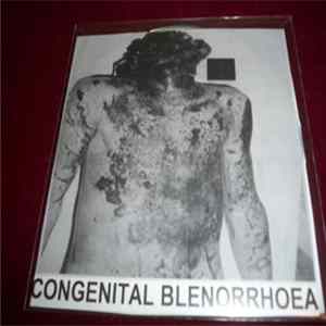 Congenital Blenorrhoea - s/t FLAC