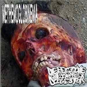 Methemoglobinemia / Defective Limb Digestor - Split FLAC