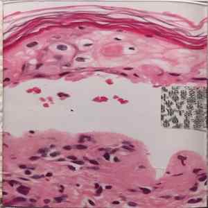 Derma - 1995 FLAC