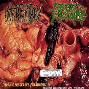 Hydropneumothorax / Septic Autopsy - Chronic Disseases Examiners (Abnormal Putrefaction And Infections) FLAC