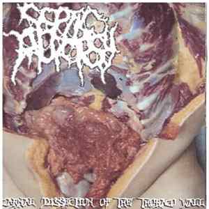 Septic Autopsy / Infester - Carnal Dissection Of The Thoraco Wall / Hidden Medico-Pathological Inquests (Part 1) FLAC