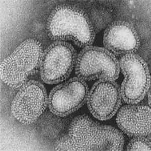 Sturmaz - Virus FLAC