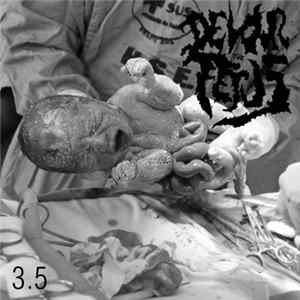 Devour The Fetus - 35 FLAC