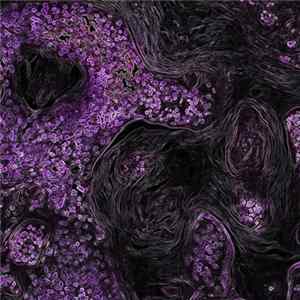 Darkness, Kerker - You Are The Cancer (Darkness & Kerker Live Acoustic) FLAC