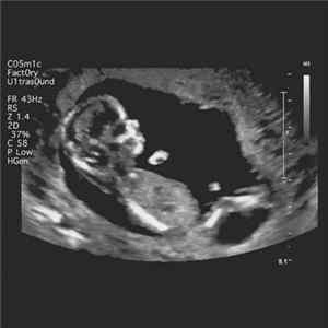 The Cosmic Factory - Ultrasound FLAC