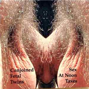 Conjoined Fetal Twins - Sex At Noon Taxes FLAC